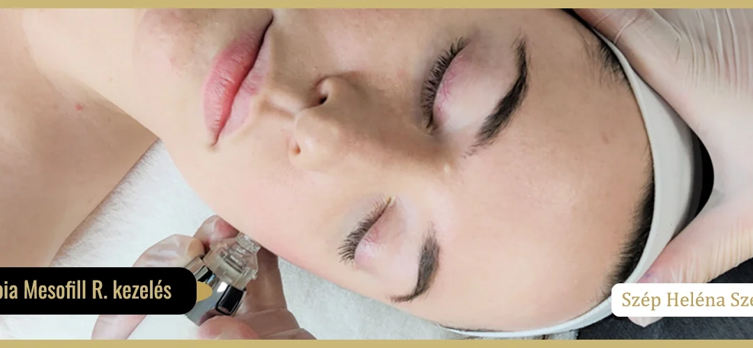 Mesotherapia Mesofill R. kezelés