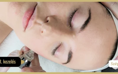 Mesotherapia Mesofill R. kezelés